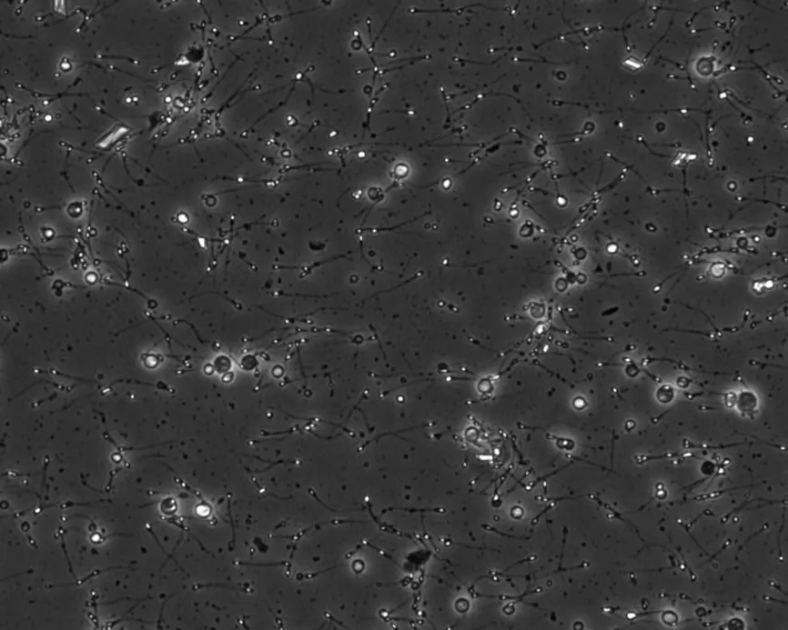 Relevance of round cells detection in spermograms
