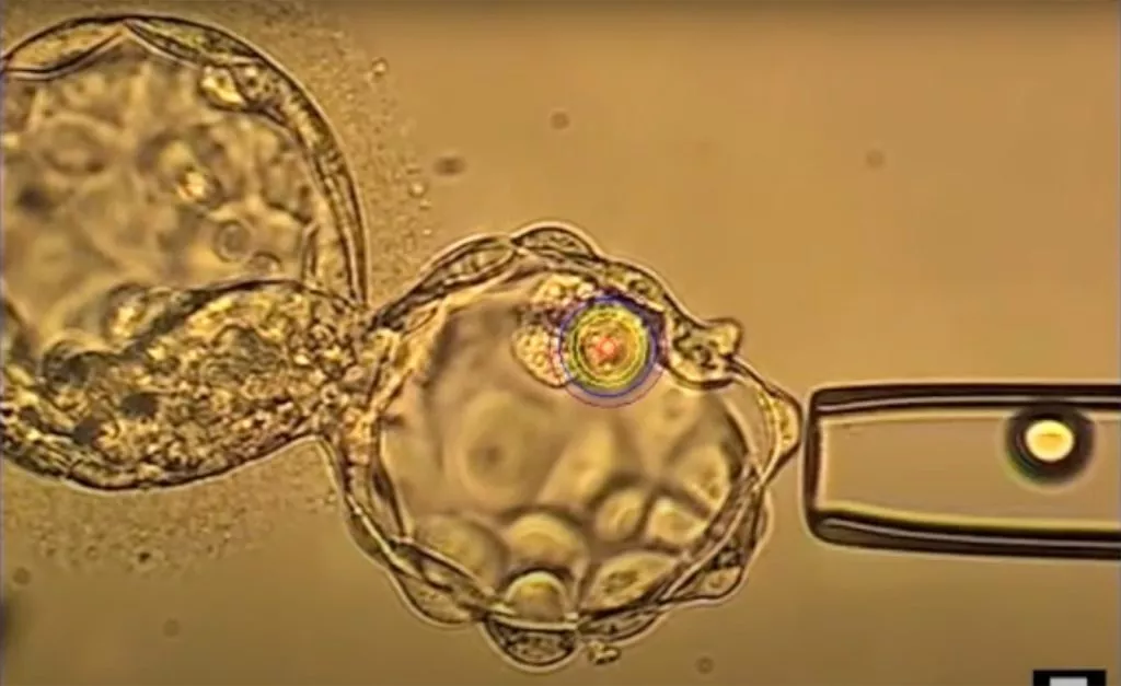 Video Tutorial: Clinical Lasers from Hamilton Thorne