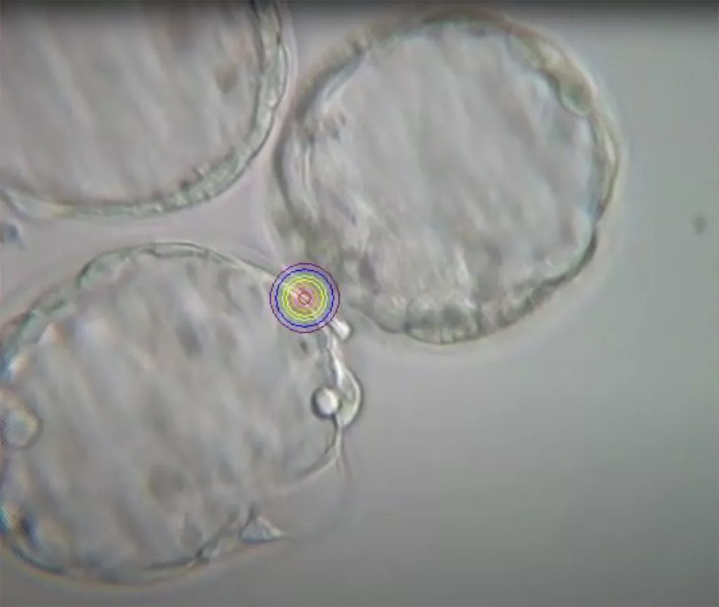 Video Tutorial: Research Lasers from Hamilton Thorne