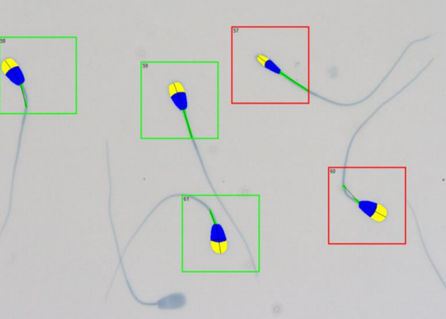 Decoding the bull: Your step-by-step guide to semi-automated morphology and morphometry assessment of bull spermatozoa