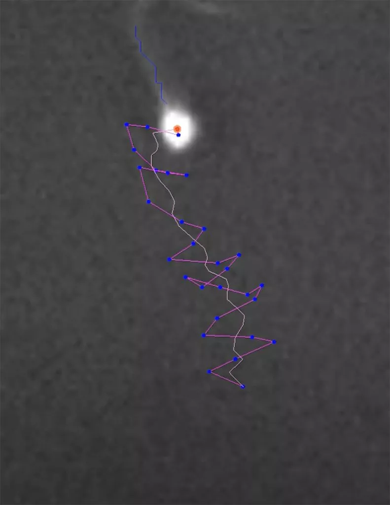 Webinar: Sperm hyperactivation – Its analysis by CASA and clinical utility